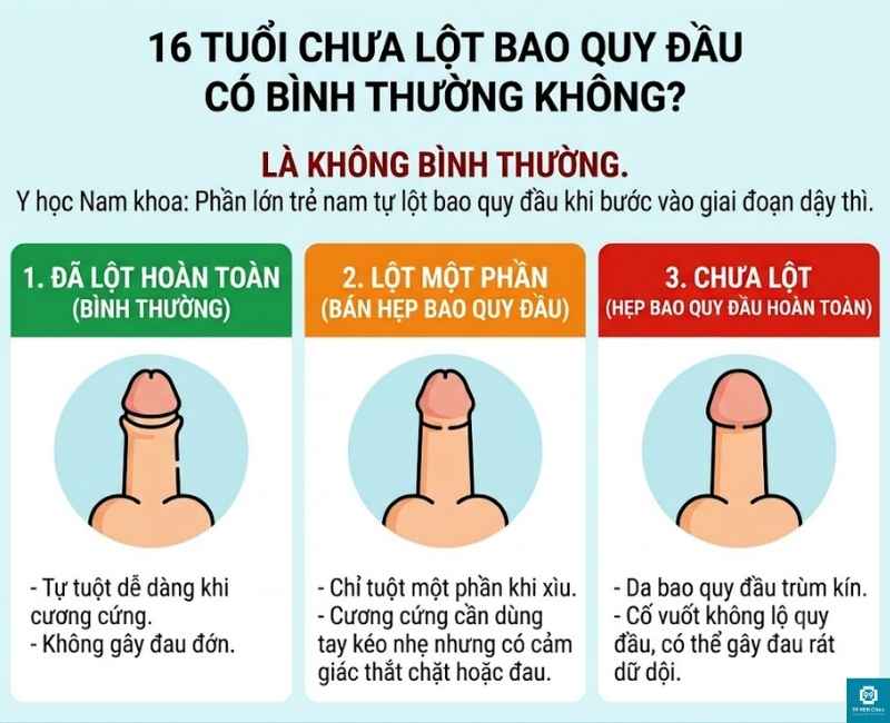 16 tuổi chưa lột bao quy đầu có bình thường không