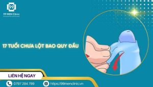 17 tuổi chưa lột bao quy đầu