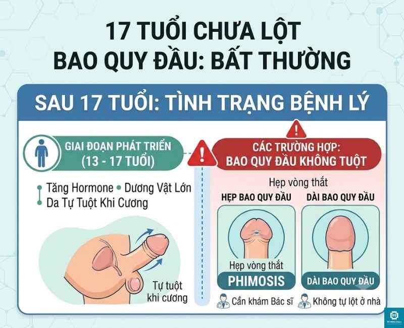 17 tuổi chưa lột bao quy đầu là bình thường hay bất thường
