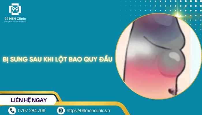 Bị sưng sau khi lột bao quy đầu