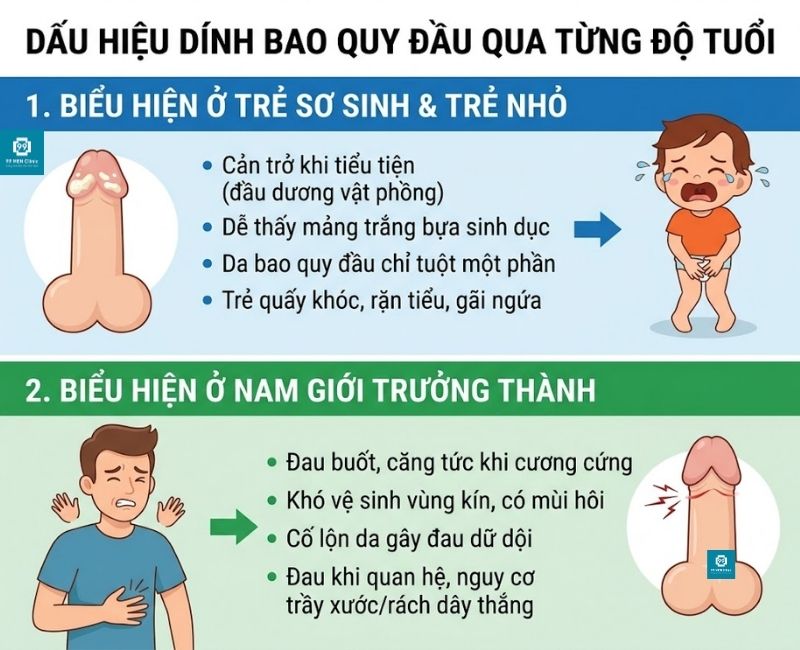 Dấu hiệu nhận biết dính bao quy đầu qua từng độ tuổi