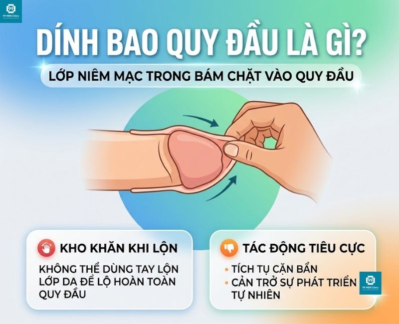 Dính bao quy đầu là gì
