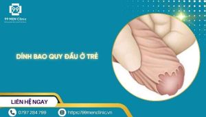 Dính bao quy đầu ở trẻ