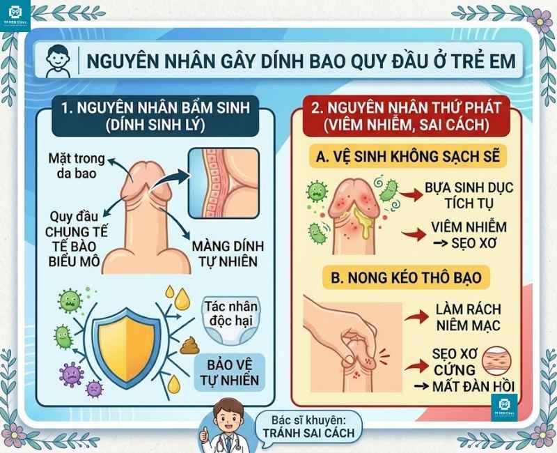 Nguyên nhân gây dính bao quy đầu ở trẻ