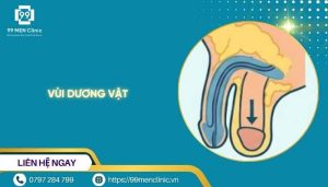 Vùi dương vật