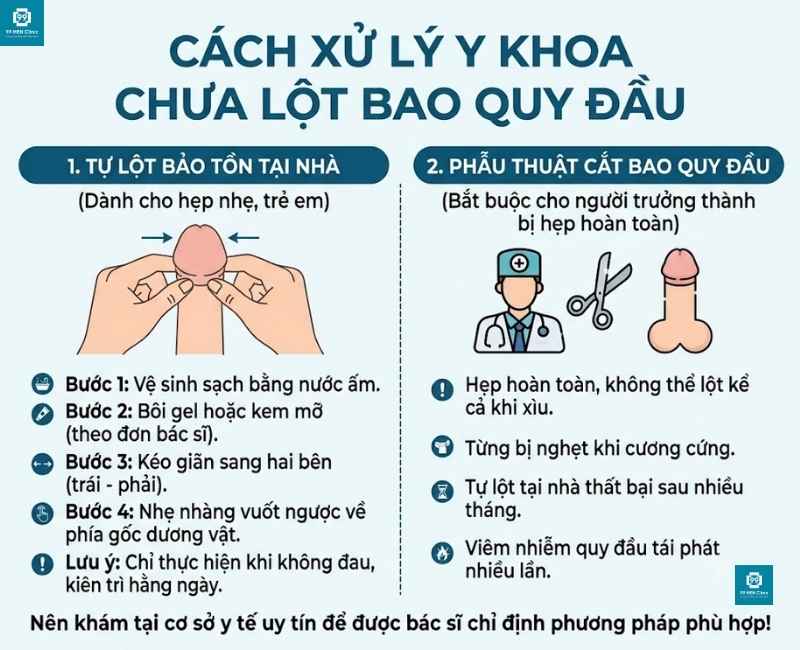 Xử lý y khoa dành cho nam giới chưa lột bao quy đầu